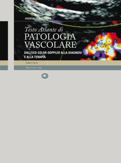 Testo Atlante di patologia vascolare - Dall'Eco-Color-Doppler alla diagnosi e alla terapia